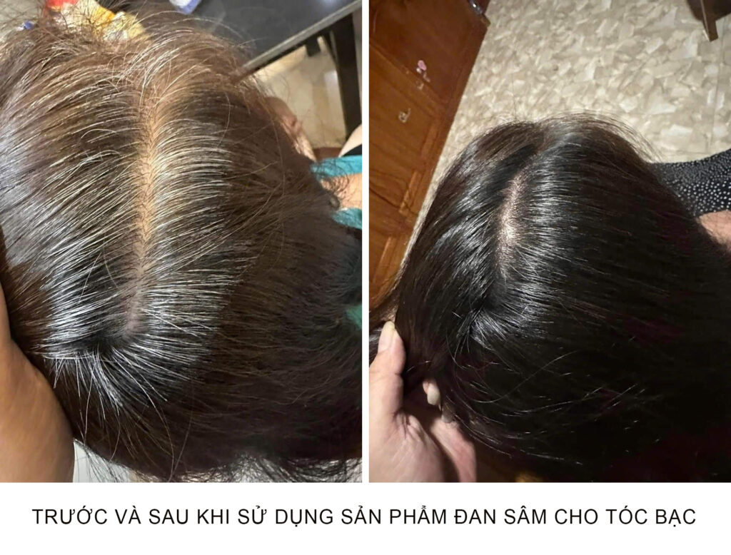 thuốc nhuộm tóc